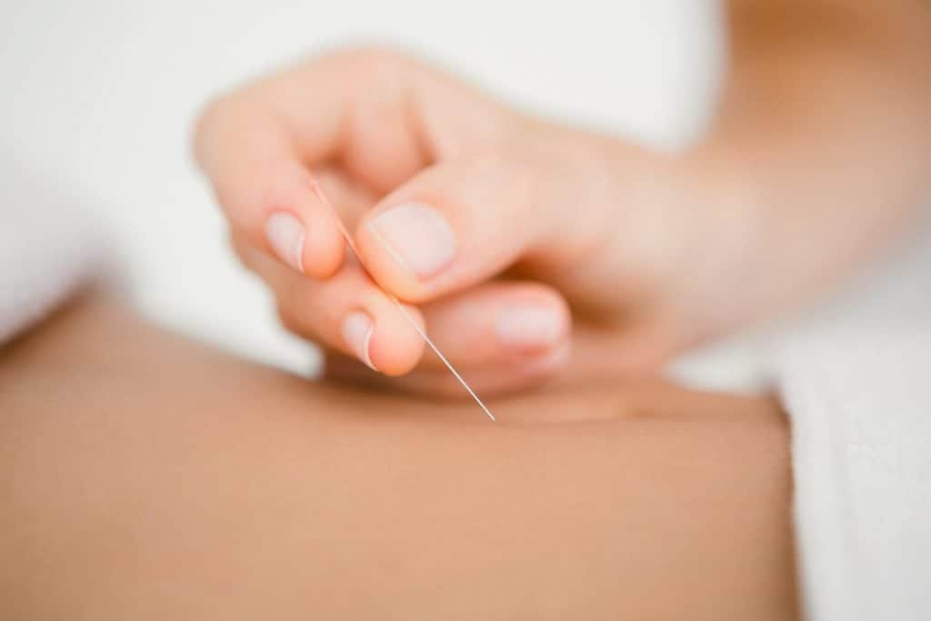 acupuncture-therapy-niles-park-ridge