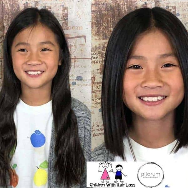 Hair Donations Northbrook Children With Hair Loss