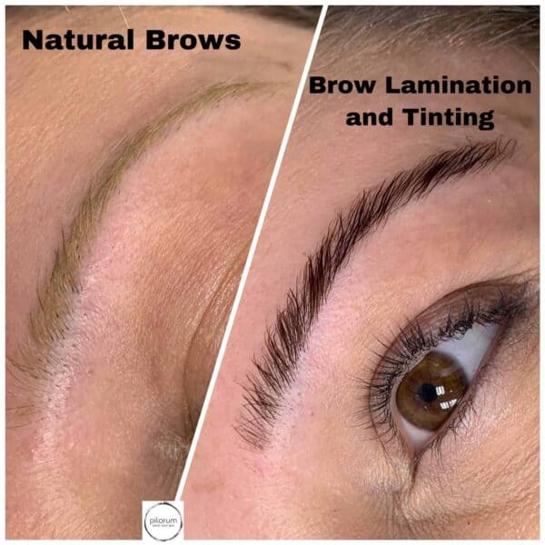 Brow Lamination Before And After